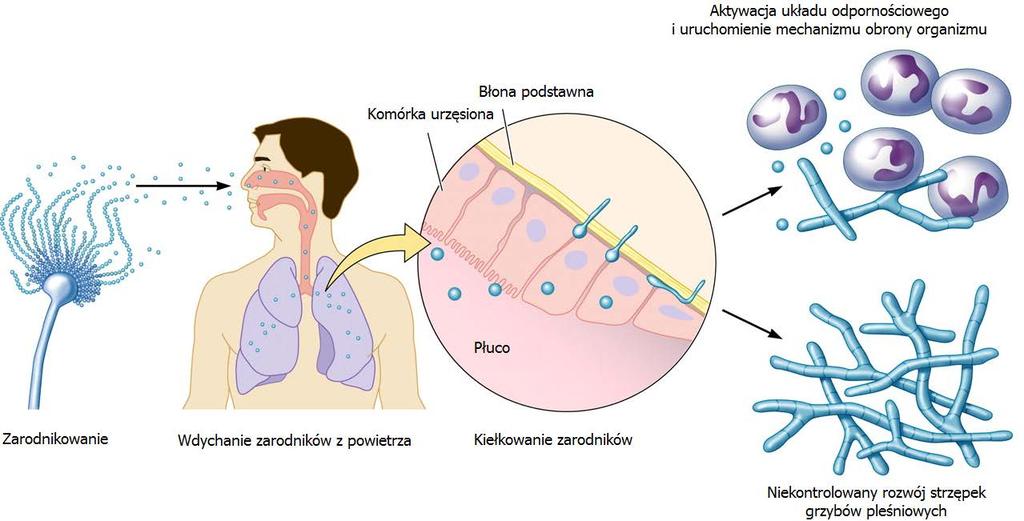 Przebieg infekcji grzybiczej Makrofagi pęcherzykowe znajdujące się w płucach stanowią pierwszą linię obrony przed wziewnymi konidiami grzybów z rodzaju Aspergillus.