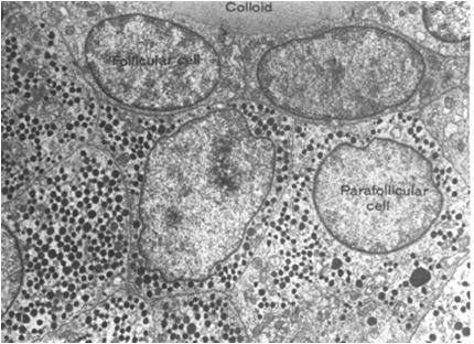 zawierają liczne ziarna wydzielnicze i produkują kalcytoninę Dlaczego