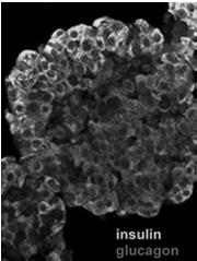 immunohistochemicznie.