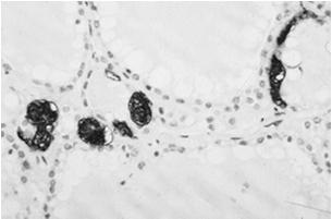 NSE) - syntetyzują peptydy Klasyfikacja komórek systemu DNES Centralne: komórki