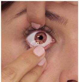 Postępowanie z przyklejoną (nieruchomą) soczewką Jeśli soczewka przykleja się do oka, specjalista może zalecić stosowanie kropli nawilżających.