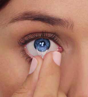 Następnie oceń dolną część oka, odciągając powiekę dolną. Gdy znajdziesz soczewkę, możesz ją zdjąć stosując metodę szczypnięcia lub inną, zalecaną przez specjalistę. Metoda szczypnięcia 1.