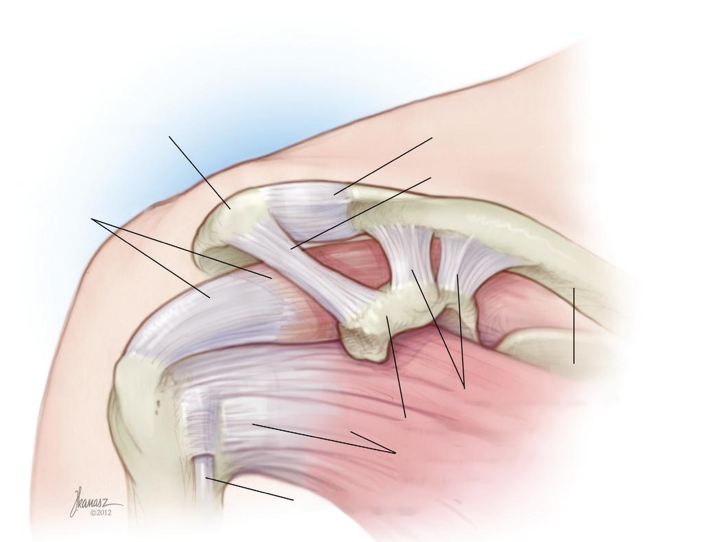 Interwał rotatorów Interwał rotatorów (ang. rotator cuff interval, RCI) to przestrzeń w kształcie trójkąta prostokątnego, zlokalizowana ponad górnoprzyśrodkową powierzchnią głowy kości ramiennej.