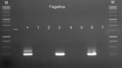 - kontrola negatywna; + kontrola pozytywna, DNA Borrelia burgdorferii (2 pg); 3, 6 wynik pozytywny; M wzorzec wielkości Perfect PlusTM1 kb (EURx). Wewnętrzny PCR (ang.