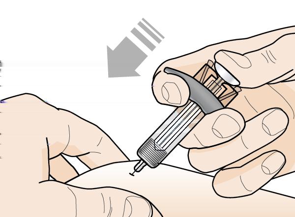 Drugą ręką delikatnie chwycić skórę w miejscu wstrzyknięcia palcami i przytrzymać.