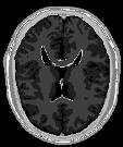 Image library Attribute extraction methods Granular attrib.