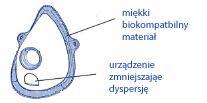 Podczas wdechu element stanowiący system ograniczania rozproszenia wychyla się do wewnątrz maski.
