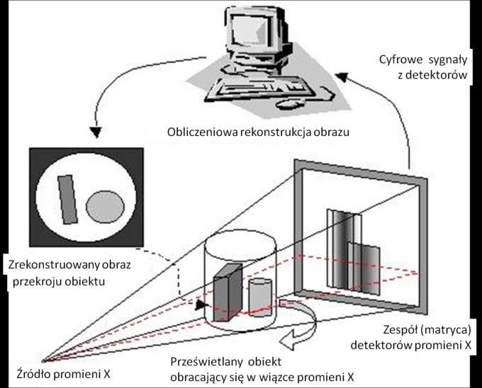 Obraz w tomografie jest otrzymywany w wyniku pomiaru pochłaniania promieniowania X przechodzącego przez badany obiekt na