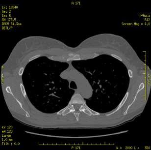 C=-700 HU C=350 HU C=40 HU W=1000 HU W=2000 HU http://212.191.70.122/medtech/pakiet6/image184.
