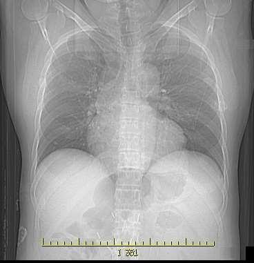 Techniki prezentacji 3D - MPR MPR Multi Planar Reconstruction, czyli rekonstrukcja wielopłaszczyznowa.