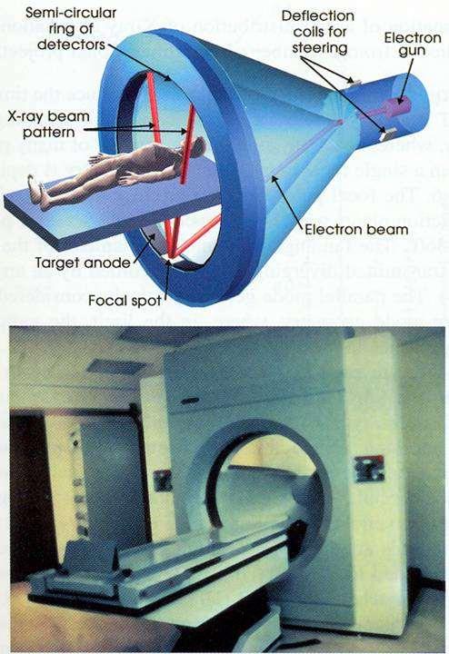 Nowoczesne tomografy EBCT