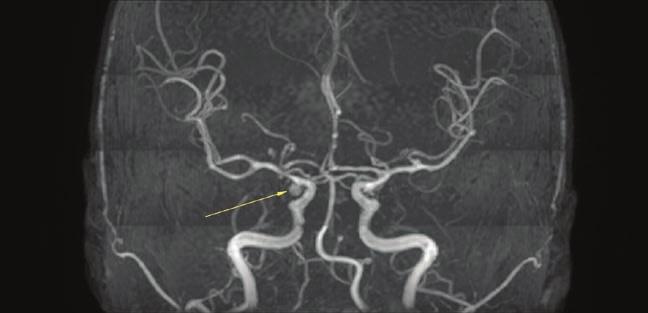 Jednakże bardzo często ostateczny sukces zależy od ścisłej współpracy nie tylko okulisty i neurologa, ale również radiologa (w tym inwazyjnego) i neurochirurga.