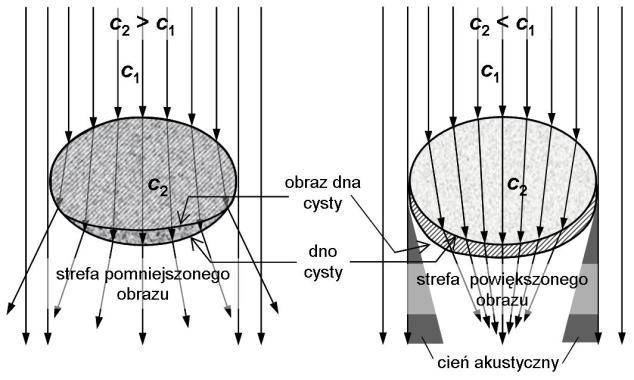 zobrazowania typu B S.3-5.