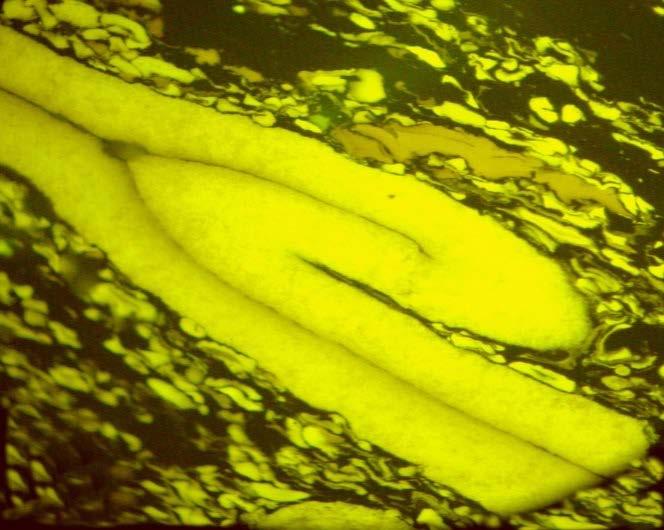 Rys. 3. Macerał z grupy liptynitu: megasporynit, światło ultrafioletowe odbite w immersji olejowej, pow. 50 Fig. 3. Liptinite (macrosporinite), fluorescence mode, immersion oil, ob. 50 Rys. 4.