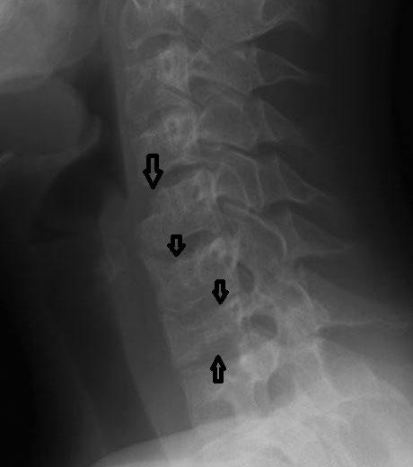Od kwietnia 2017 roku rodzice ponownie nie zgłaszali się z dzieckiem do Kliniki, przerwali leczenie.