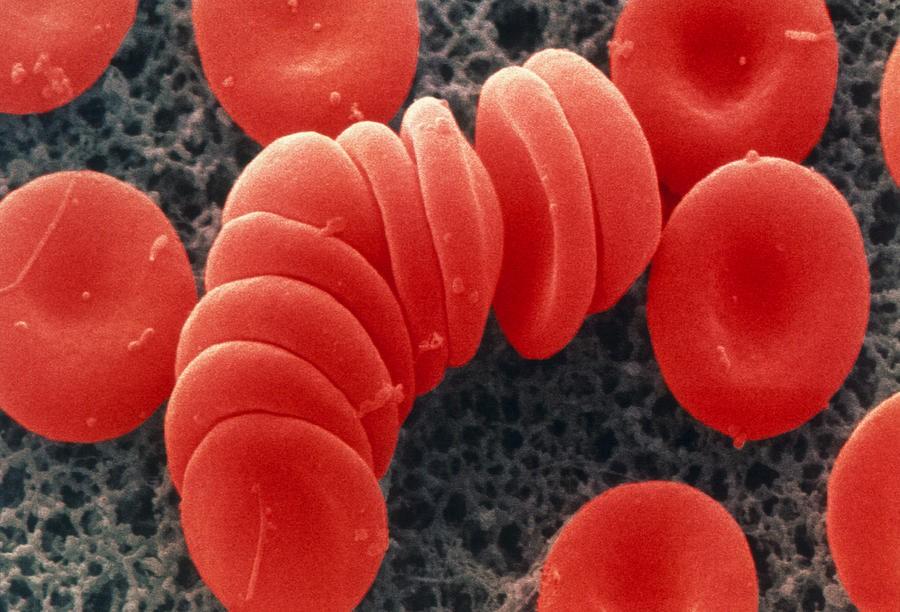 Hemoreologia Agregacja krwine