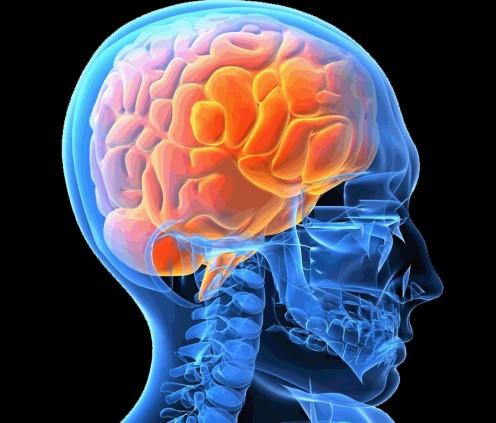 Zaburzenia lepkości krwi a choroby neurologiczne Stwardnienie rozsiane wzrost lepkości krwi - niższa wartość parametru związanego z agregacją erytrocytów, przy równoczesnym wyższym wskaźniku