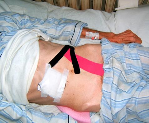 Denko, która jako pierwsza stworzyła plaster