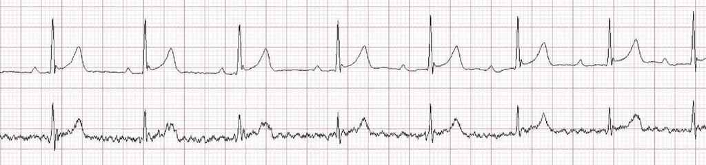 Rafał Baranowski Teraz mamy już komplet informacji klinicznych i elektrokardiograficznych.