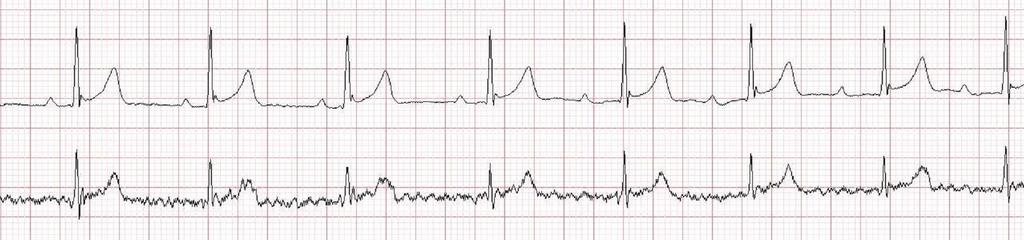 Rafał Baranowski Teraz mamy już komplet informacji klinicznych i elektrokardiograficznych.