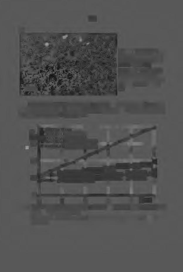 453 b) Cd. rys. l. Mikrostruktura siluminu niemodyfikowanego (a) oraz po modyfikacji 0,6% AITi5B + 0,3% P (b) Contd. fig. l. Microstructure o f the unmodified silumin (a) and the silumin modified with use 0,6% A!