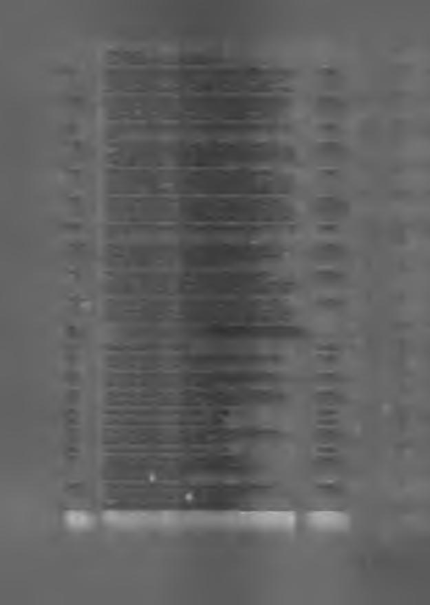 zakresu pól: od <100MU/min do >500MU/min. 1.7.