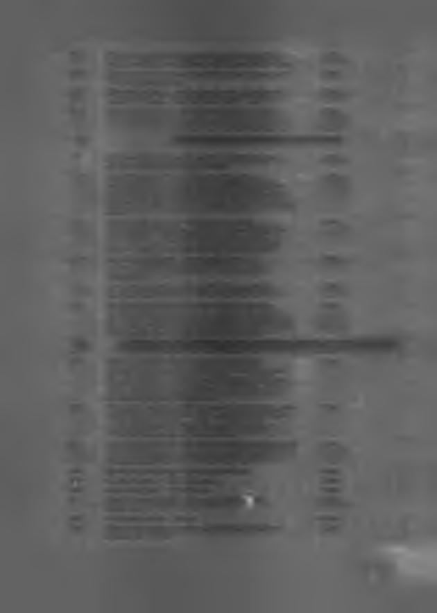 6.9. Zmechanizowane wysuwanie detektora do zadanej pozycji roboczej i wycofanie do pozycji spoczynkowej 6.10. Detektor przesuwany w osiach X i Y w zakresie min. 11,