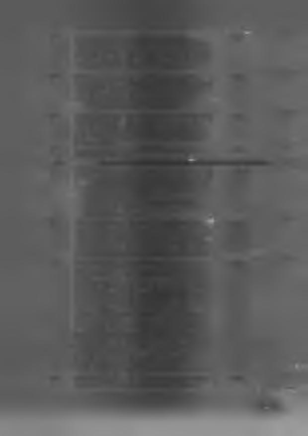 11.3. Automatyczna i cykliczna akwizycja obrazów radiograficznych 2D sterowana cyklem oddechowym pacjenta lub zadanymi przez użytkownika interwałami czasowymi lub interwałami dawki lub zadanymi przez