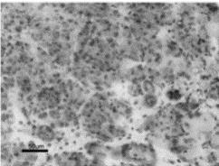 fibrozy [Fig.1].