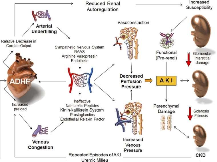 Patogeneza CRS 1 Ronco et al.