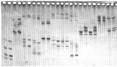formowanie siê hybryd O 6 -mg/t, które s¹ rozpoznawane przez system MMR (ryc. 1.).