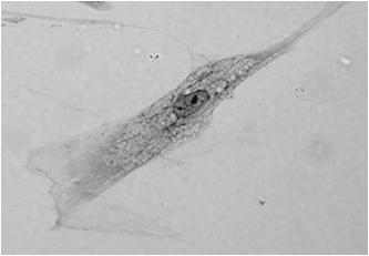 szorstka aparat Golgiego egzocytoza konstytutywna Pochodzenie: z komórek mezenchymatycznych