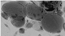 Adipocyt jednopęcherzykowy: duży (do 100 μm) pojedyncza wielka kropla lipidowa otoczona siecią