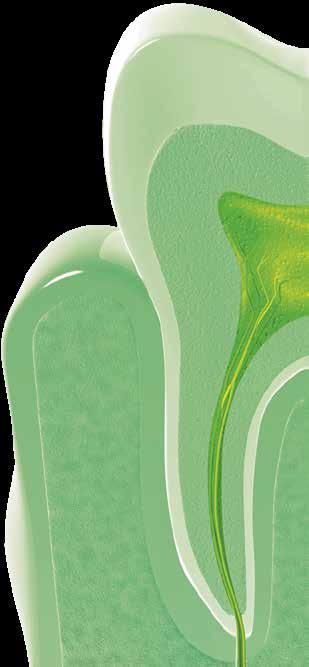ENDODONCJA URZĄDZENIE BEZPRZEWODOWE CanalPro CL Ergonomiczny kształt i kontrola Duży, przyjazny dla użytkownika wyświetlacz LCD Pamięć 5 programów Tryb Auto-Reverse 6 ustawień głowicy pozwala na