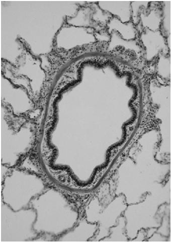 histologiczny) oskrzela główne oskrzela (wewnątrzpłucne) oskrzeliki oskrzeliki końcowe oskrzeliki