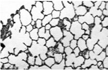 Pęcherzyki płucne średnica 0,2 mm ok.