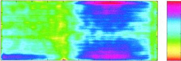 time-frequency map of ST segment obtained from a person after surgical correction of Fallot s syndrome by means of separate ECG aligning by T template. 8B.