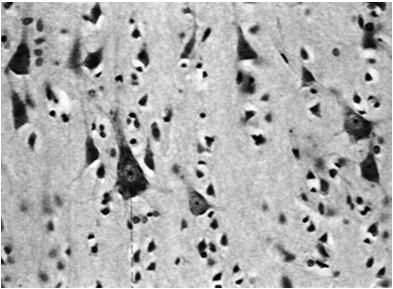 podstawne) pobudliwość przewodnictwo Komórka nerwowa: ciało komórkowe (perykarion) wypustki