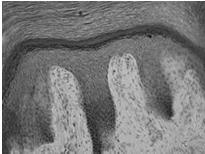 z zakończeniami nerwowymi są mechanoreceptorami Skóra właściwa: