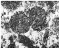 organelle pozostaje cytoplazma z licznymi pęczkami filamentów