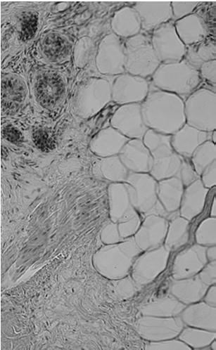 zamykające łączące keratynocyty warstwy ziarnistej Tkanka podskórna: - tkanka tłuszczowa i tkanka łączna wiotka