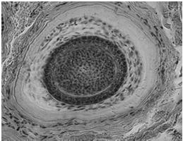 brodawka włosa z kapilarami, otoczona przez - macierz (komórki namnażające się: keratynocyty, melanocyty)
