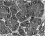 Komórki wydzielnicze (pęcherzykowe) to typowe komórki