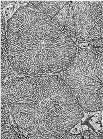 śródpęcherzykowe są morfologicznie i czynnościowo podobne do komórek