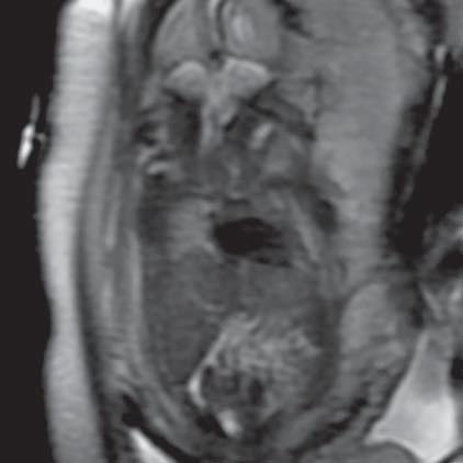 Ryc. 26.