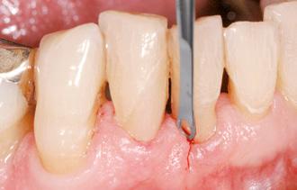 6] Zalecenia dot.