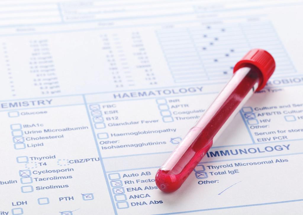 OPIEKA NAD CHORYM PO DIAGNOZIE Badania funkcji wątroby ALT: 7-55 U/L AST: 8-48 U/L GGT lub gamma GT: 9-48 U/L Bilirubina: 0.1-1.0 mg/dl Badania wątroby mierzą poziom pewnych enzymów i białek we krwi.