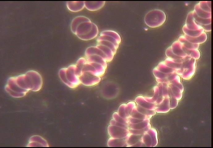 Erytrocyty (czerwone krwinki) mają we krwi ujemny ładunek elektryczny, aby się nie skupiały, tylko