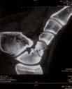 patients [6] stopa prawa stopa lewa Rycina 3.