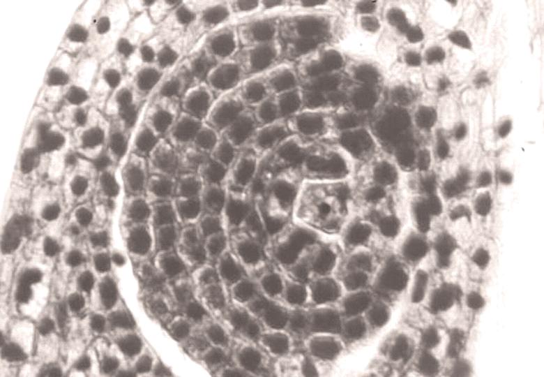 1 2 Fot. 1 2. Przekrój pod³u ny przez kwiat wiechliny ³¹kowej; 1 w oœrodku zal¹ ka widoczna komórka archesporialna, 2 tetrada makrospor. Phot. 1 2. Longitidiunal section Kentucky blue-grass flower; 1 archespore cell in the ovule, 2 tetrad of microspores.